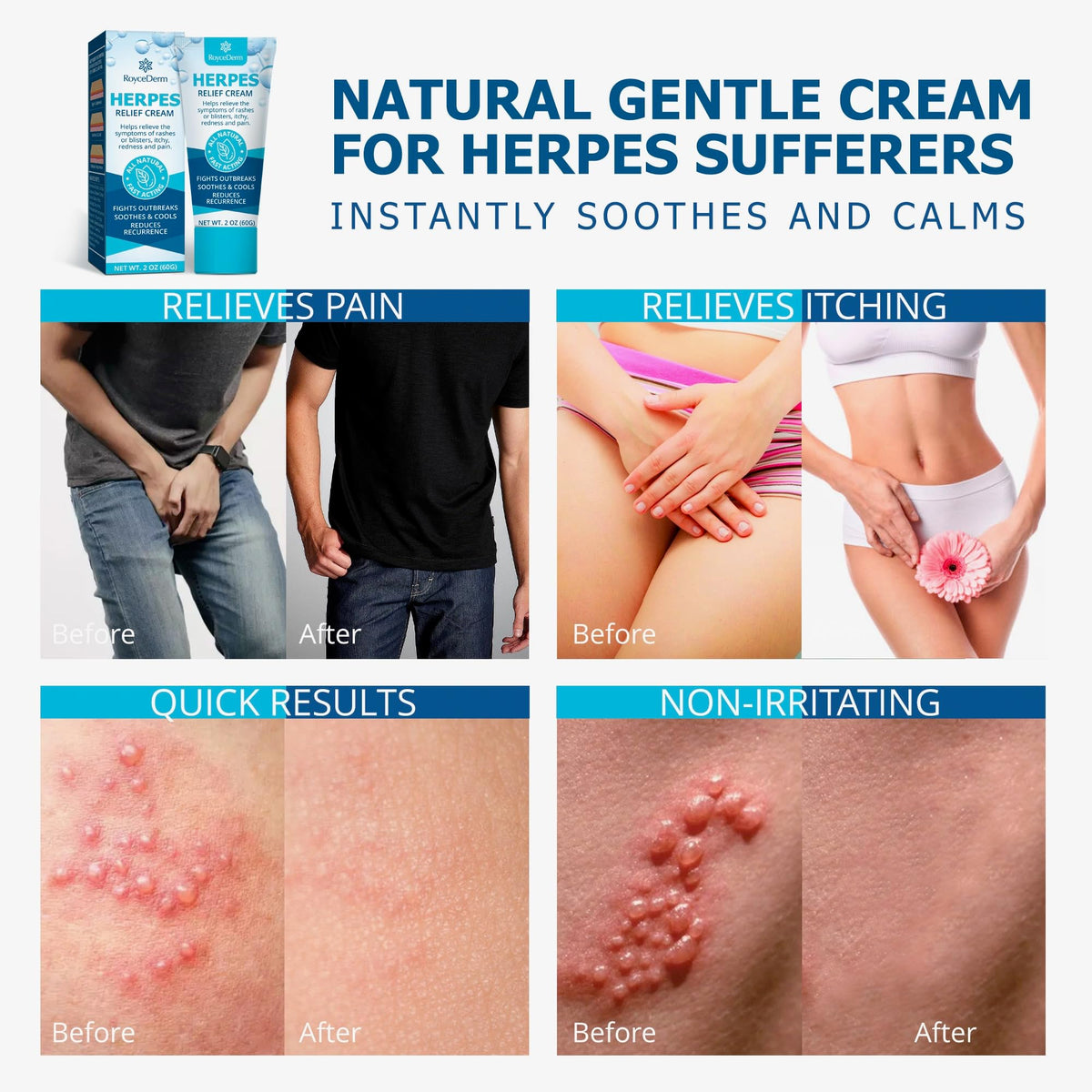Herpes Cream Q1895